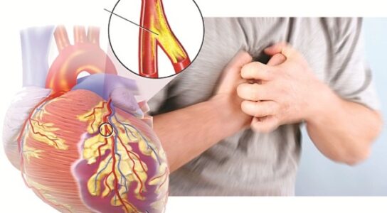 Sống Chung Với Bệnh Suy Tim 4 sống chung với bệnh suy tim